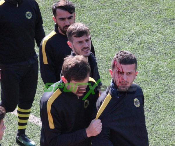 Karasu'da maç başlamadan olay çıktı